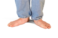 Ways to Reduce Pain From Flat Feet